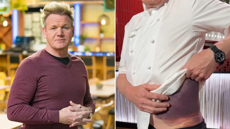 Gordon Ramsay Lucky To Be Alive Following Serious Bicycle Accident