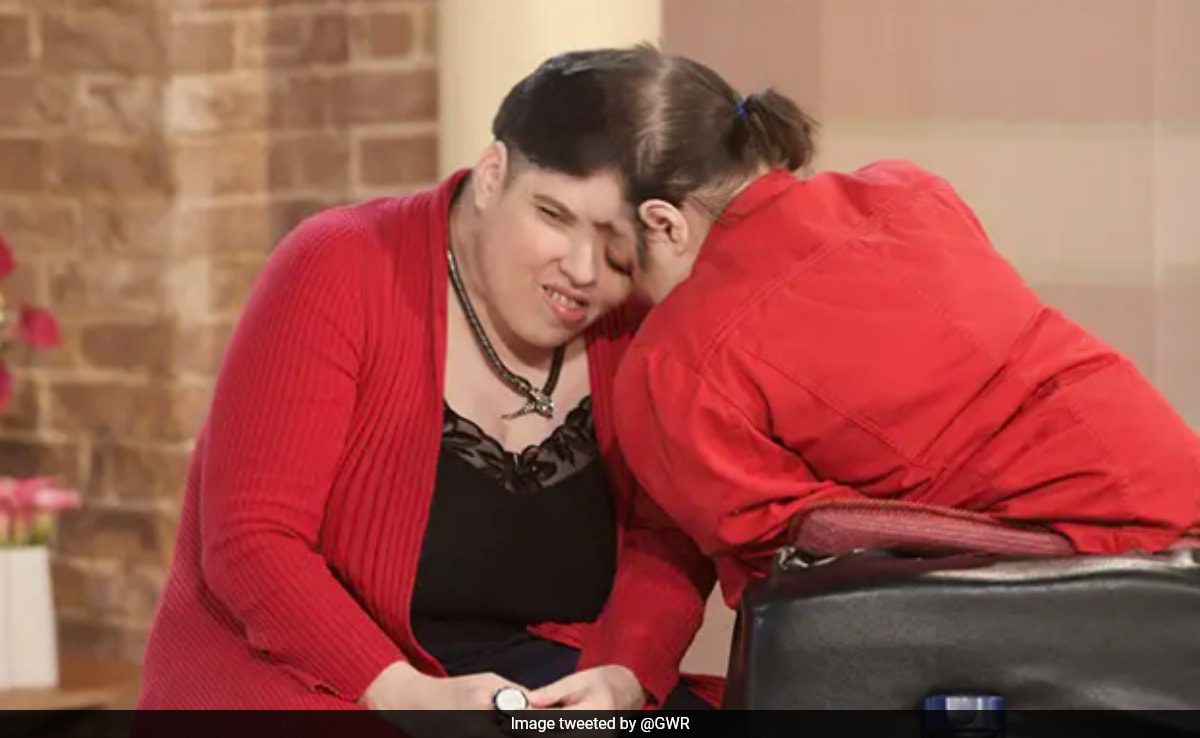 World’s Oldest Conjoined Twins, Lori And George Schappell, Die At 62 ...