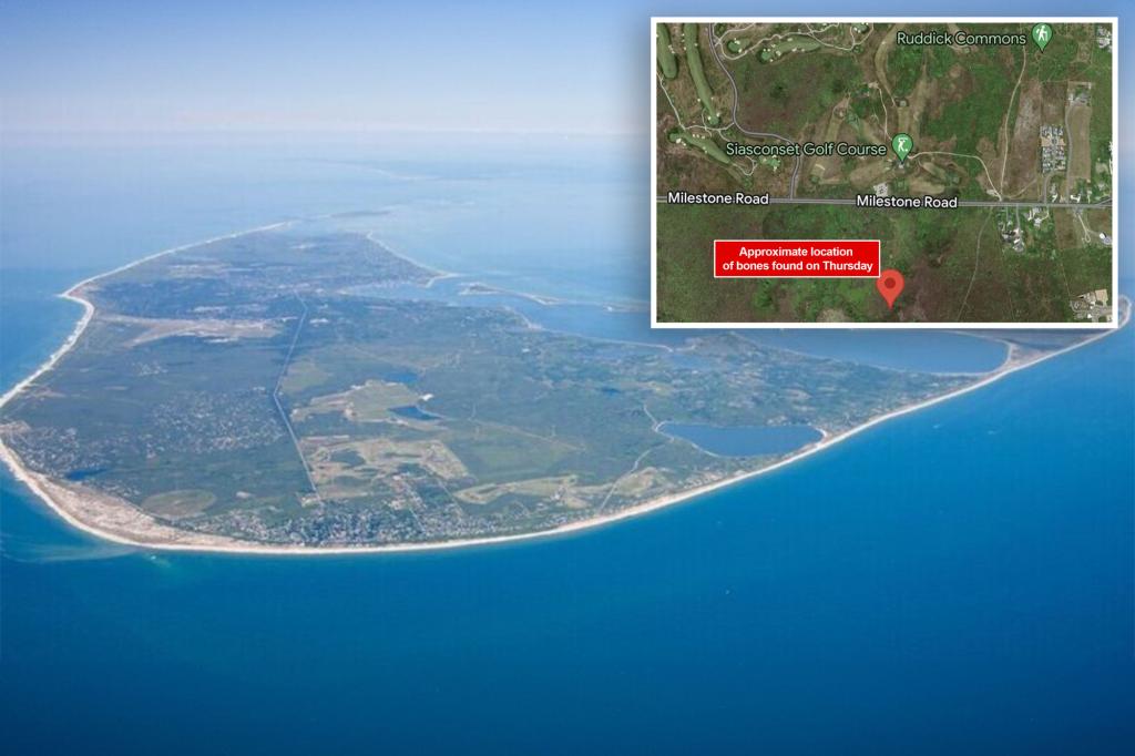 Human skull, bones found in Nantucket swamp; foul play possible - Total ...