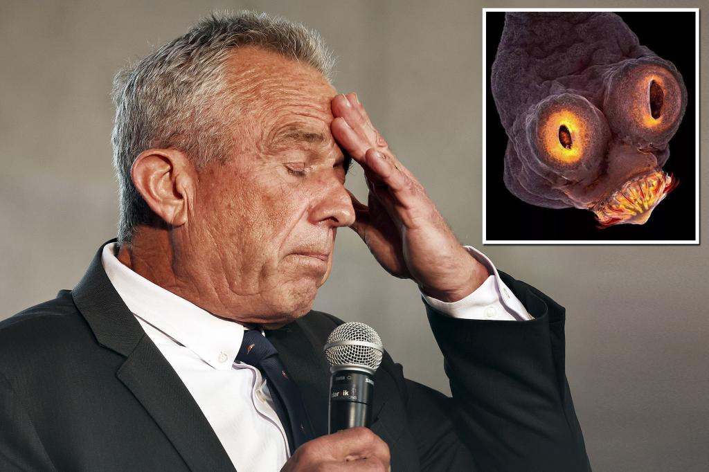 RFK Jr. said doctors found a dead worm in his head after it ate part of ...