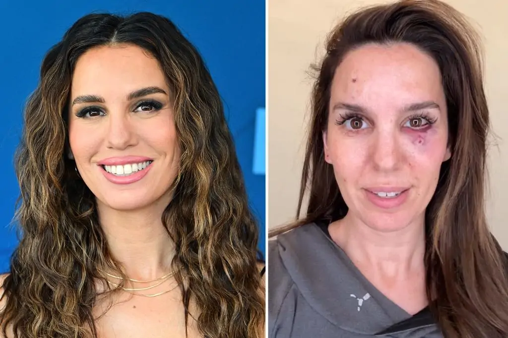 Christy Carlson Romano 'shot in the eye' during clay pigeon shooting outing  with her husband for his birthday | Total News