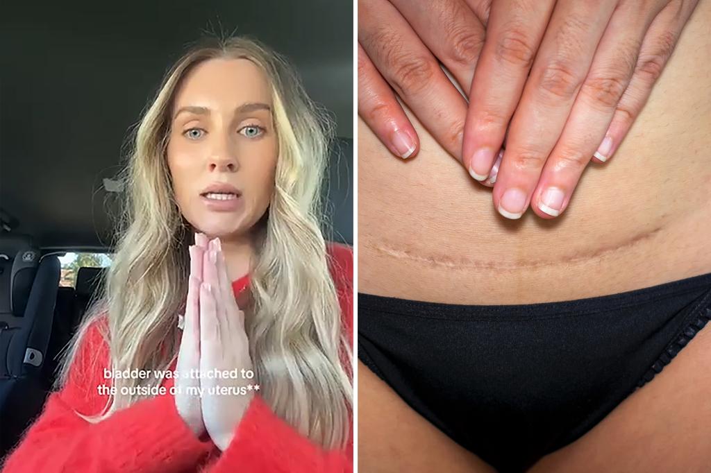 A mother shares a terrible story: there's a baby in there, but it has passed away.