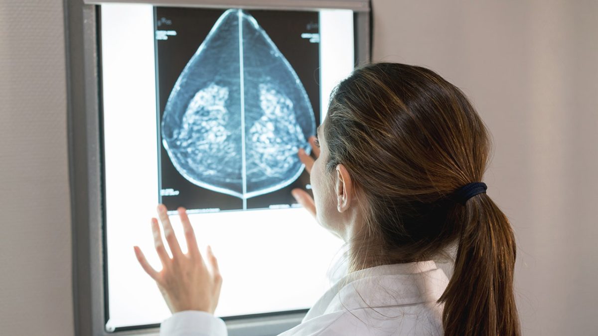 AI tool for breast cancer receives FDA approval, utilizes mammograms to assess risk