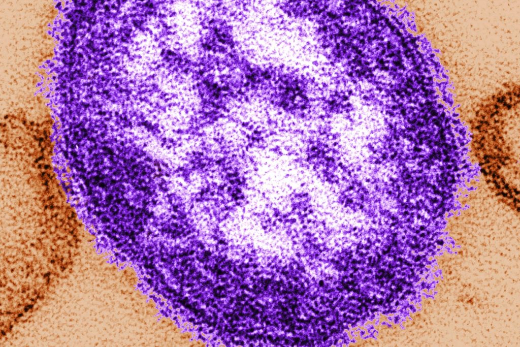 Another potential measles exposure is being looked into in Northern Virginia