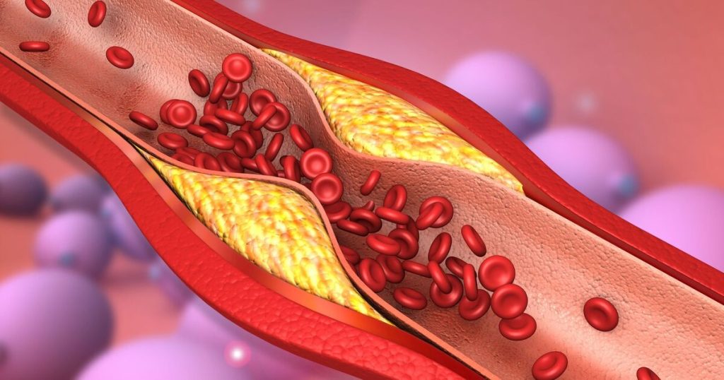 Cholesterol-rich superfood clears arteries more effectively than aspirin