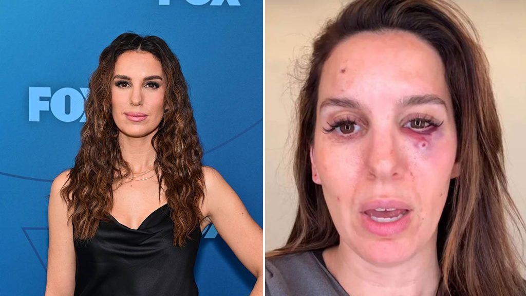 Christy Carlson Romano shares surprising information about almost losing her eye