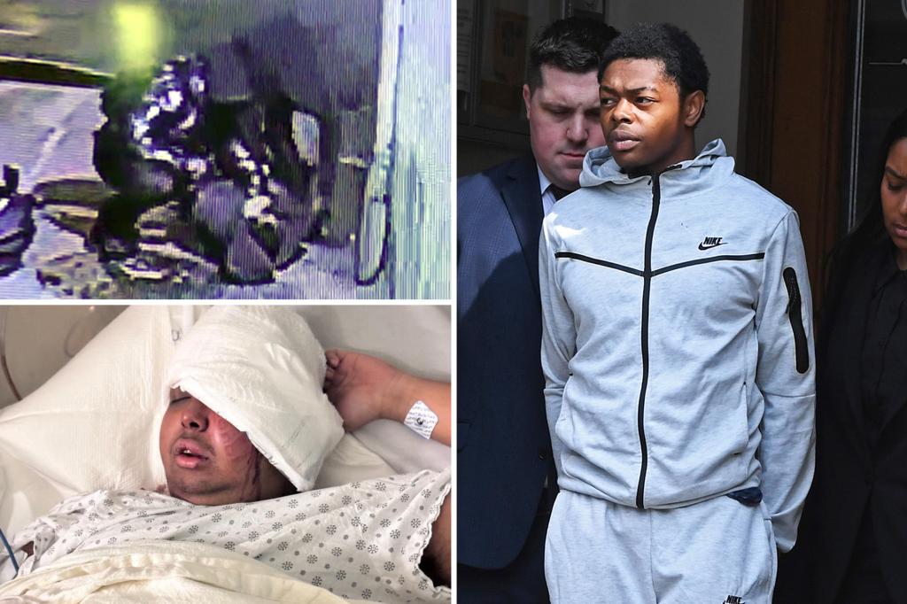 Couple charged with violently attacking and robbing NYPD newcomer left shoeprint on his face: prosecutors