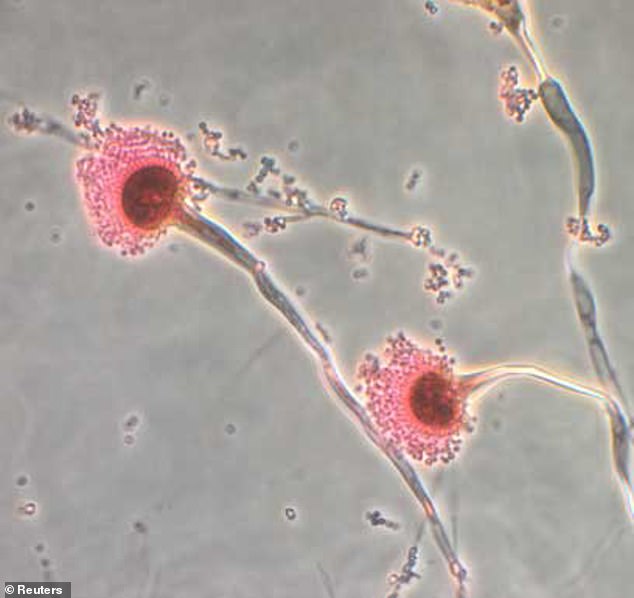 Dangerous fungus that 'destroys you from within' spreads in the US: 'Hundreds of thousands of lives in danger'