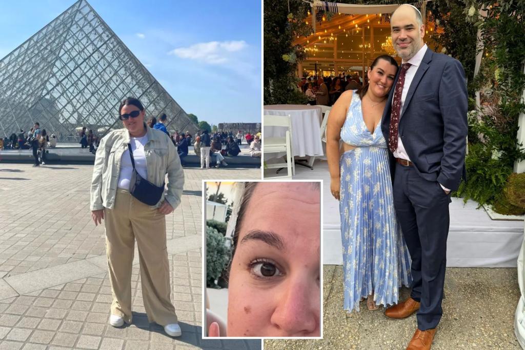 Doctors overlooked my mole — how I realized it was skin cancer