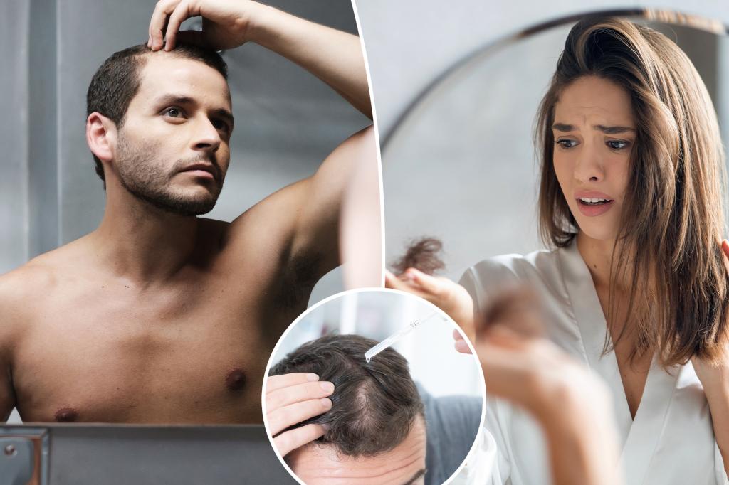 Effective hair loss treatments and potential side effects to consider