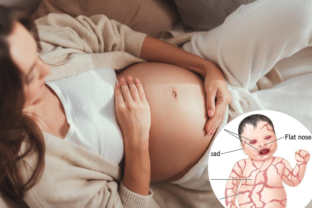 Exploring the condition that leads to babies being born with scales