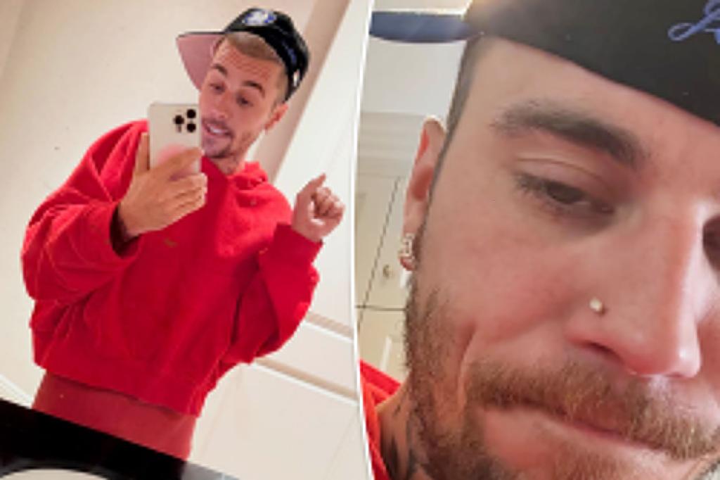 Fans urge Justin Bieber to seek assistance as he seems to be having a hard time in recent photos.