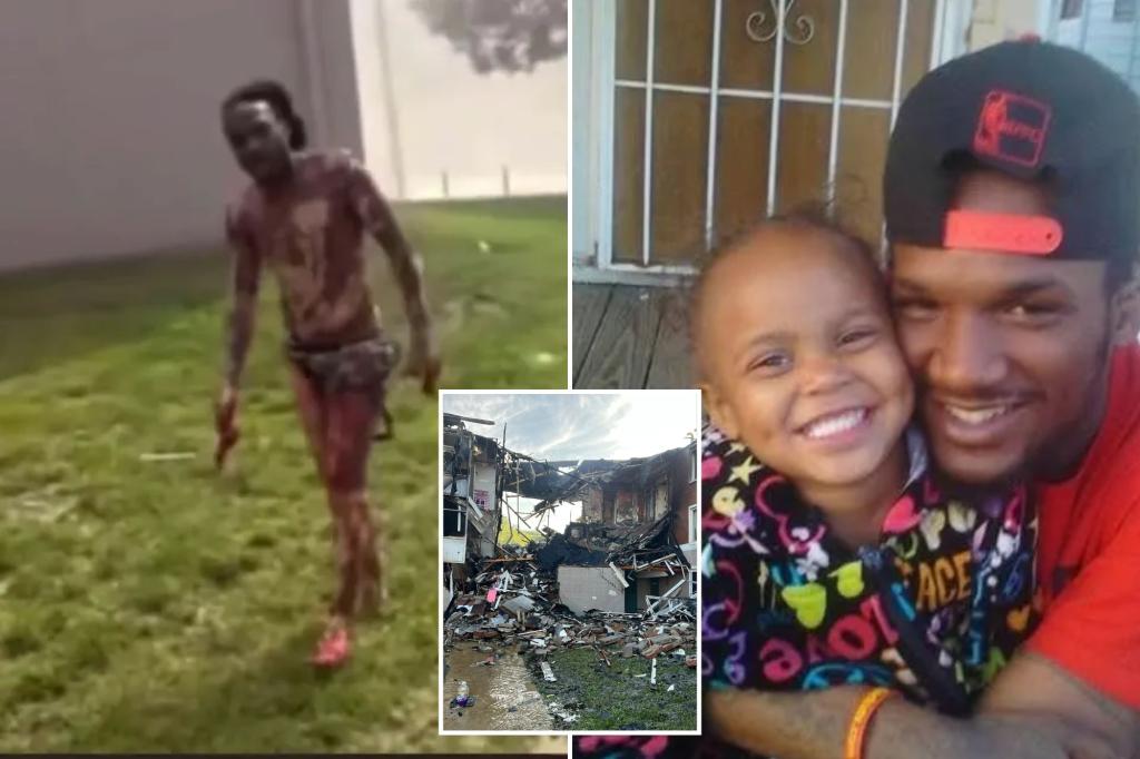 Father endures burns over 92% of his body while rescuing stepchildren from house explosion: 'Appeared like a zombie'
