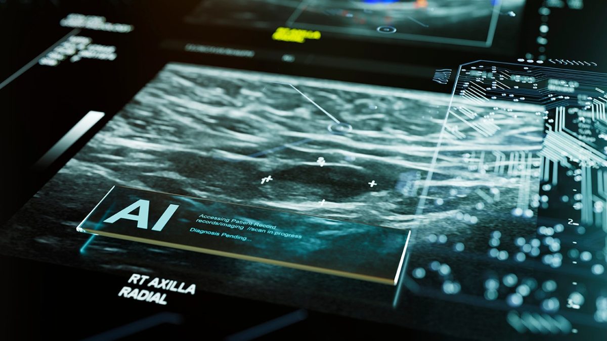 First AI tool to assess breast cancer risk receives FDA approval