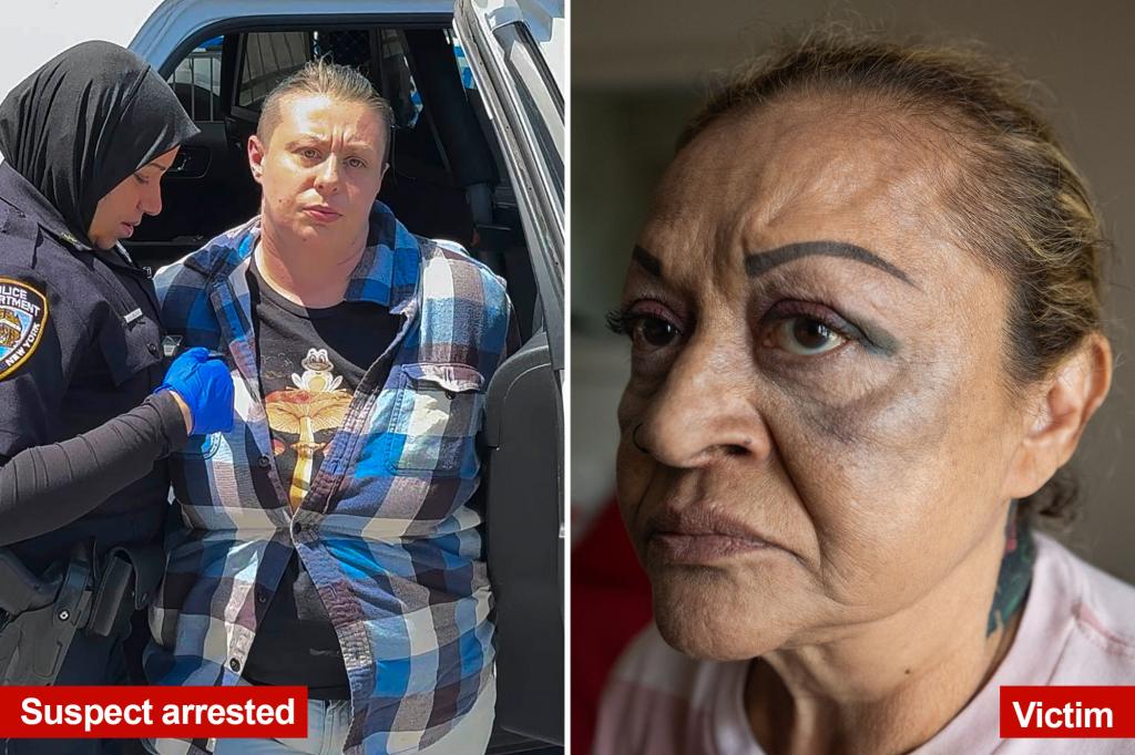 Great-grandmother from Queens assaulted by unstable woman on NYC subway can't shake the feeling that her attacker is still 'following' her.