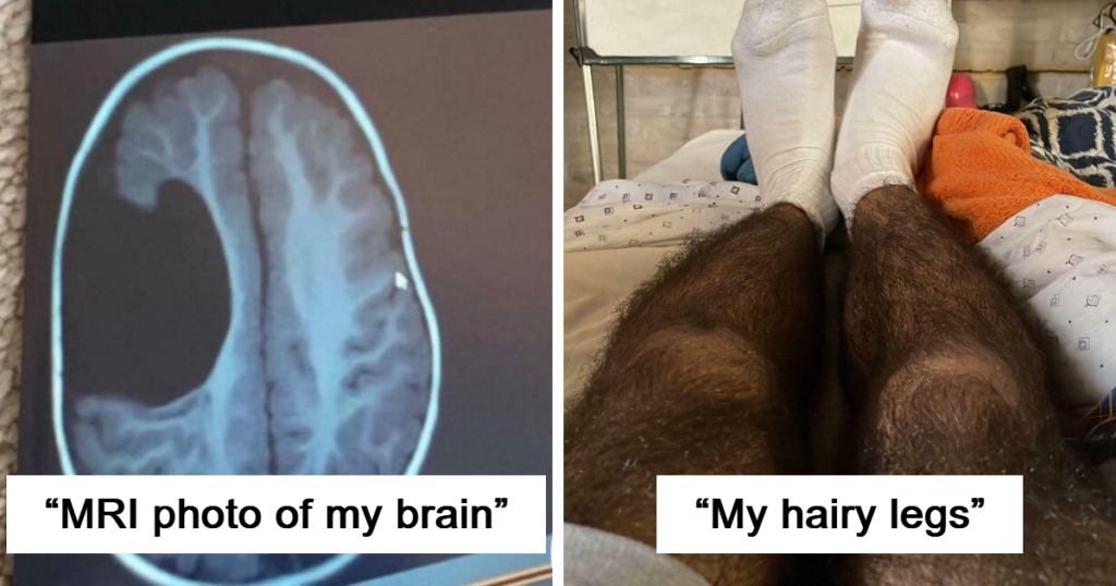 "Hair Growing in the Eye": 86 Surprising Images That Reveal the Strange and Intriguing Aspects of the Human Body