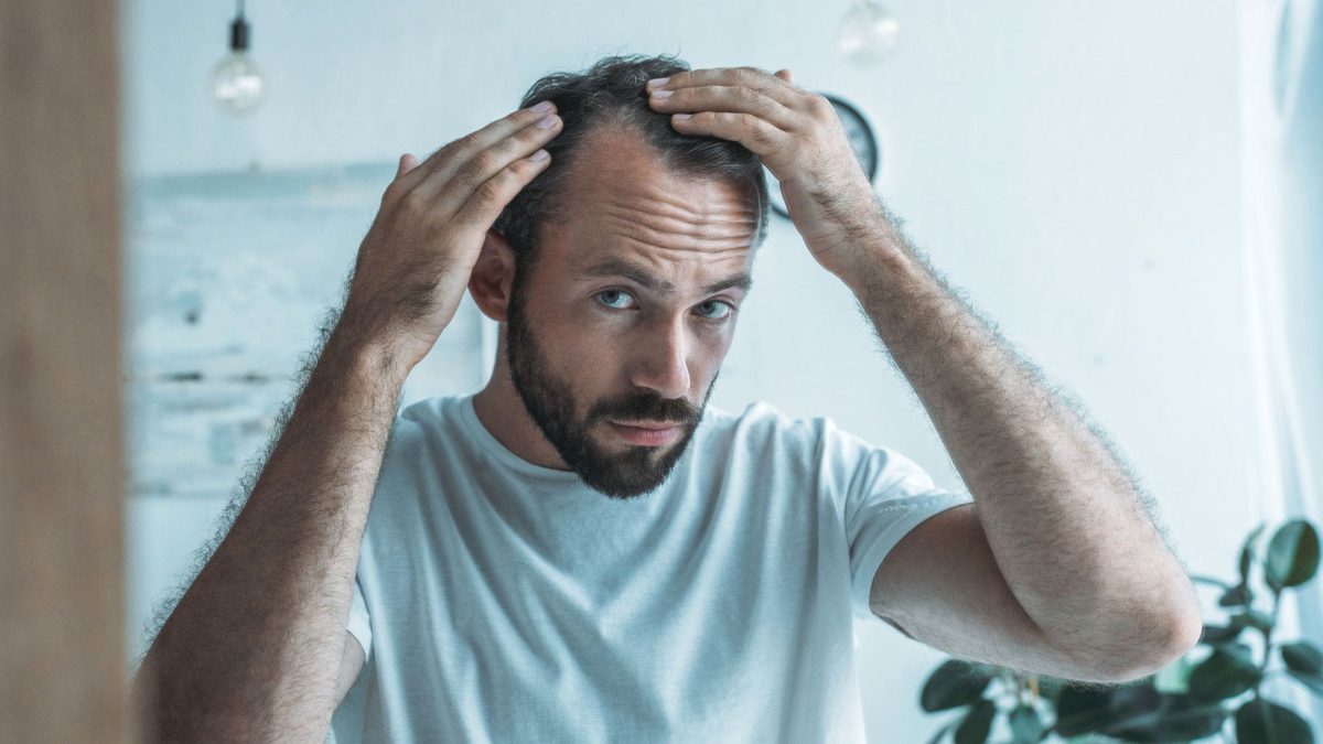 Hopeful stem cell treatment for hair loss may be accessible in five years.