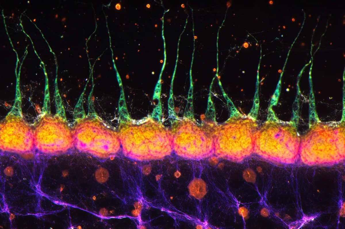 Inhibitory Neurons Could Be Essential for Spatial Learning and Memory