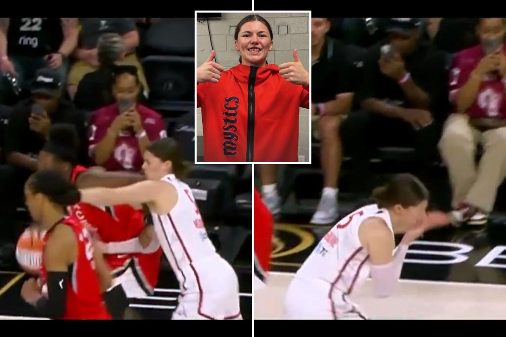 Jade Melbourne sustains tooth injury in bloody incident after being struck in the face