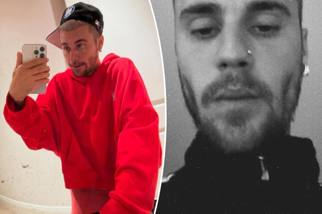 Justin Bieber responds to worries about his health