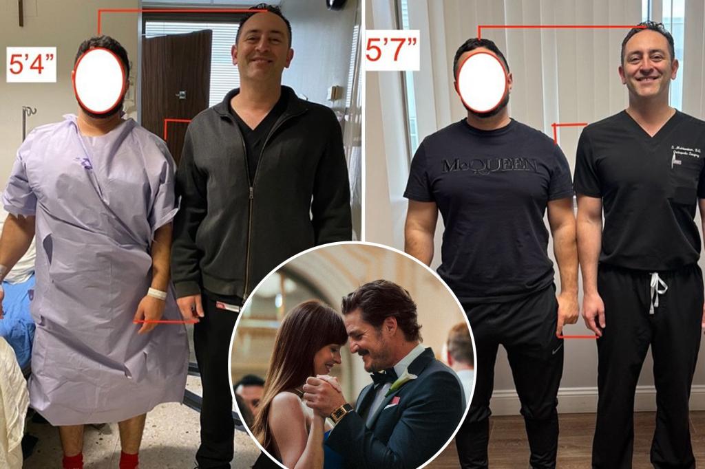 Leg-lengthening surgery from 'Materialists' exists — here's why individuals spend thousands on the 'Frankenstein' procedure