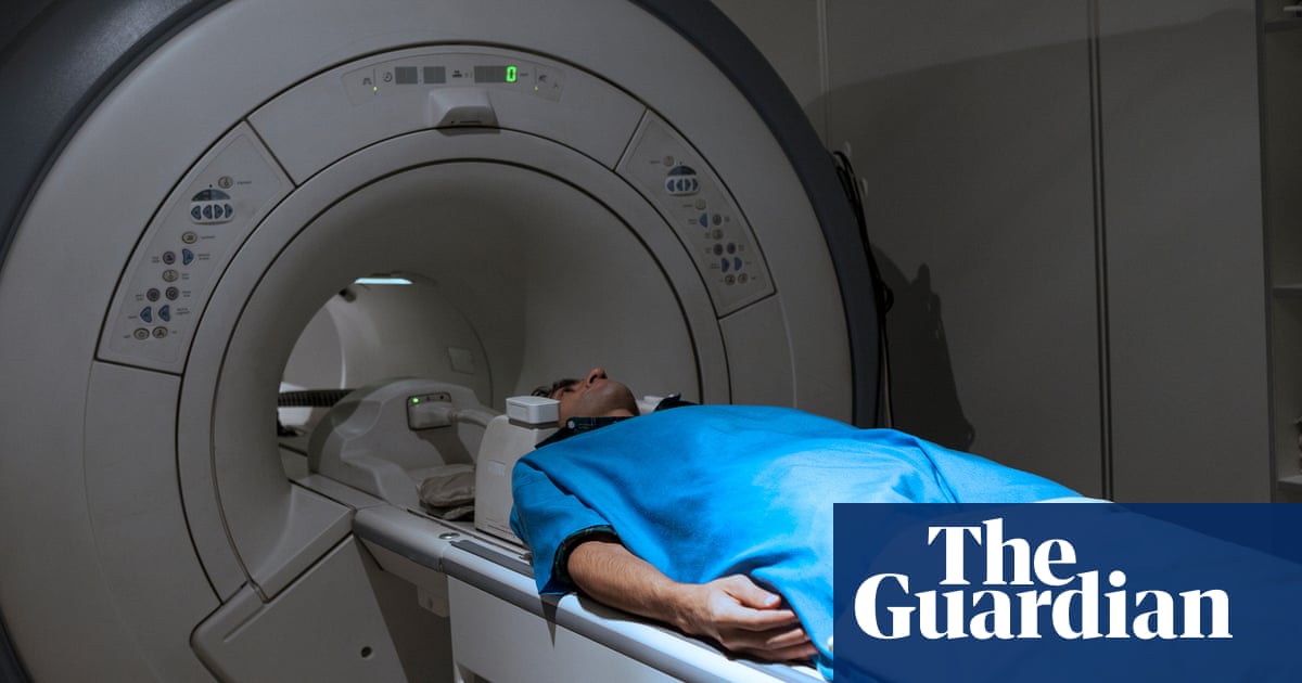 Many people in the west are unaware they have serious fatty liver disease, study finds