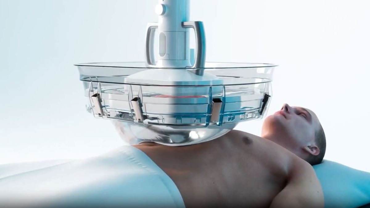 NHS to use ultrasound treatment without surgery to focus on tumors