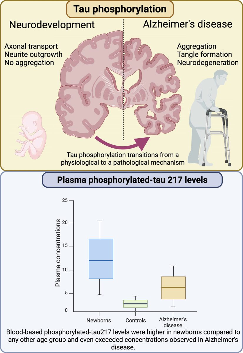 Newborns show higher levels of a biomarker linked to Alzheimer's.