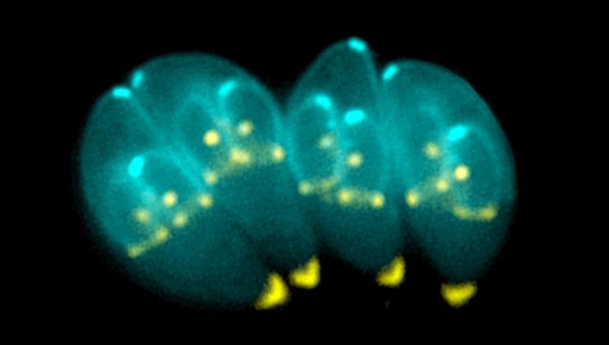 Parasite from Meat and Cat Feces Disturbs Human Brain Communication