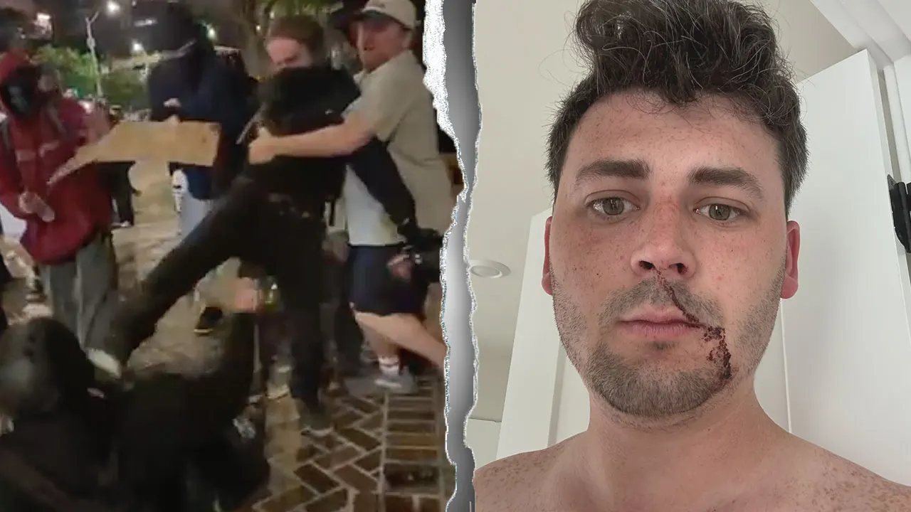 Reporters assaulted at demonstration accuse the press of hiding the violence.