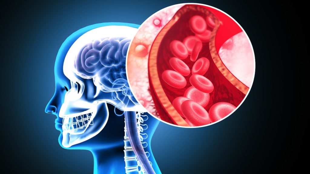Stanford creates milli-spinner tool for improved stroke therapy