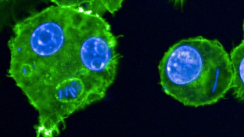 This genetic change allowed the Black Death to persist for centuries.