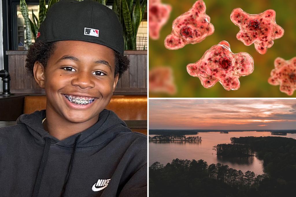 12-year-old boy passes away from brain-eating amoeba following a swim