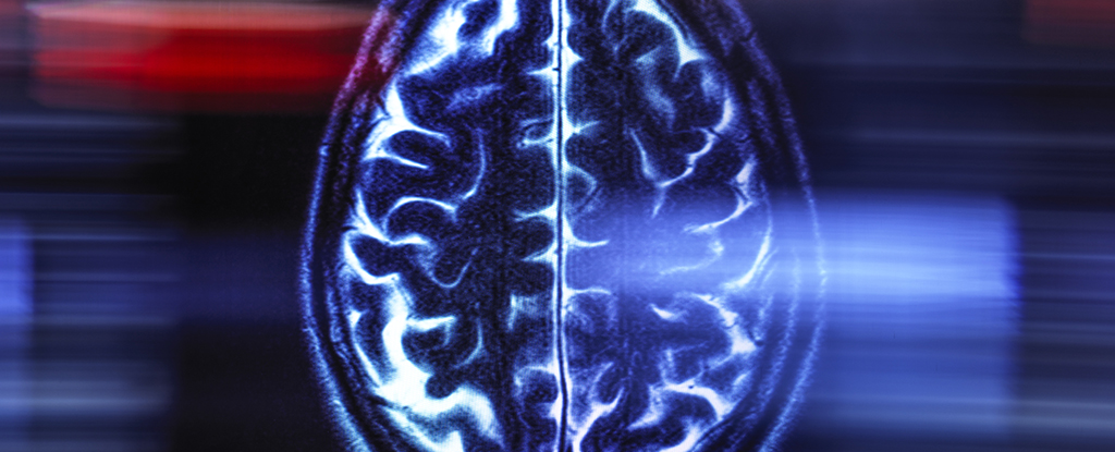 A Brain Scan at Midlife Can Indicate Your Aging Rate