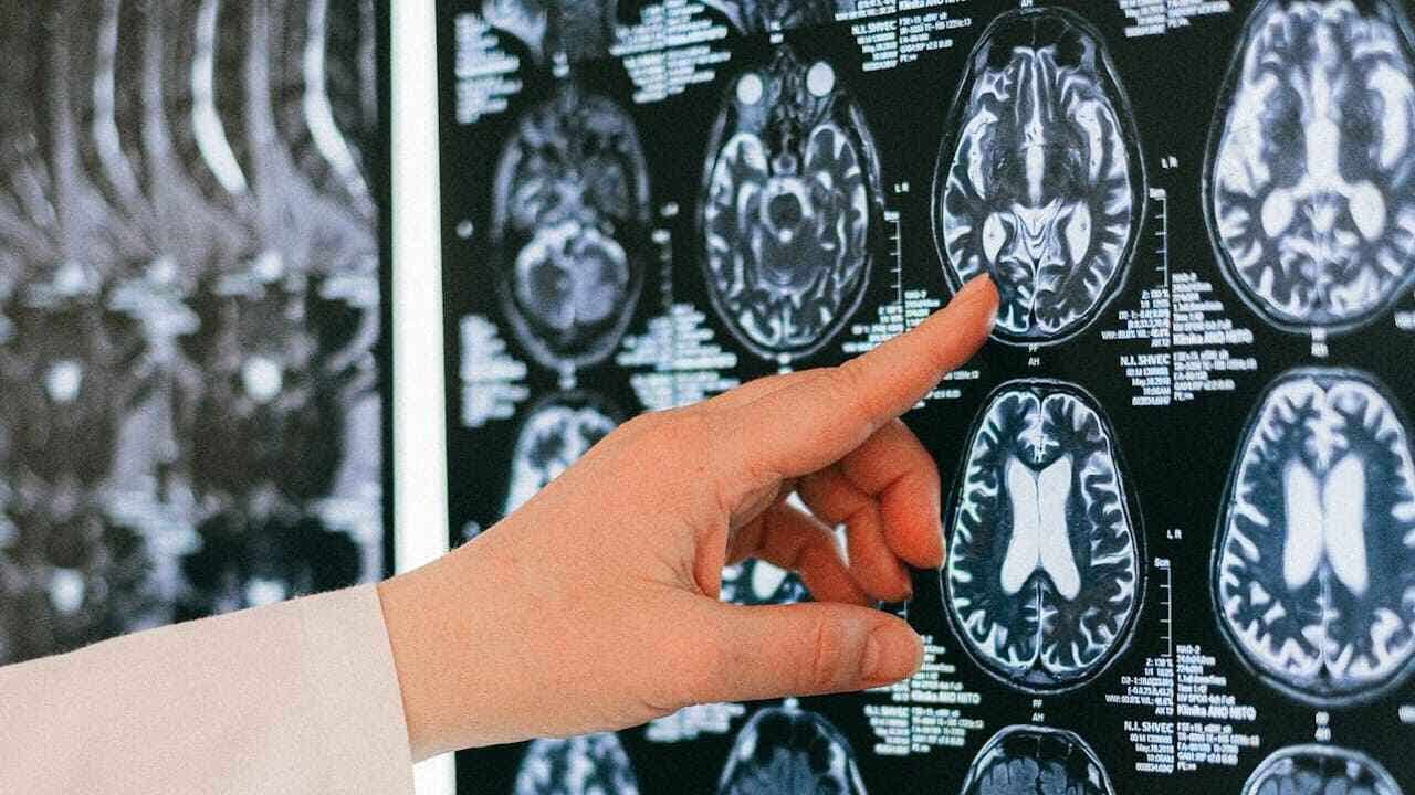 AI brain scan device estimates your aging speed