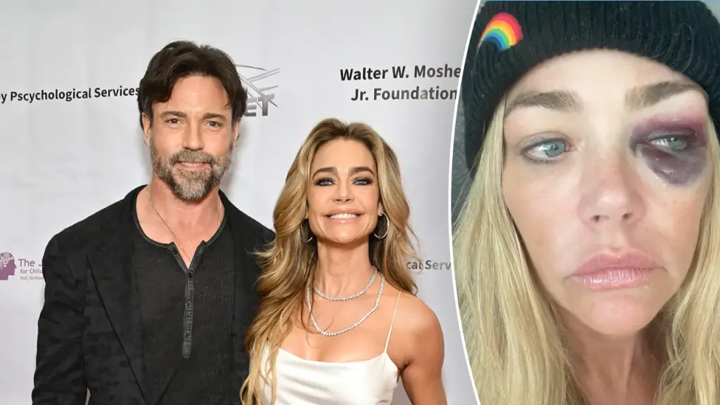 Aaron Phypers refutes Denise Richards' claims of domestic violence