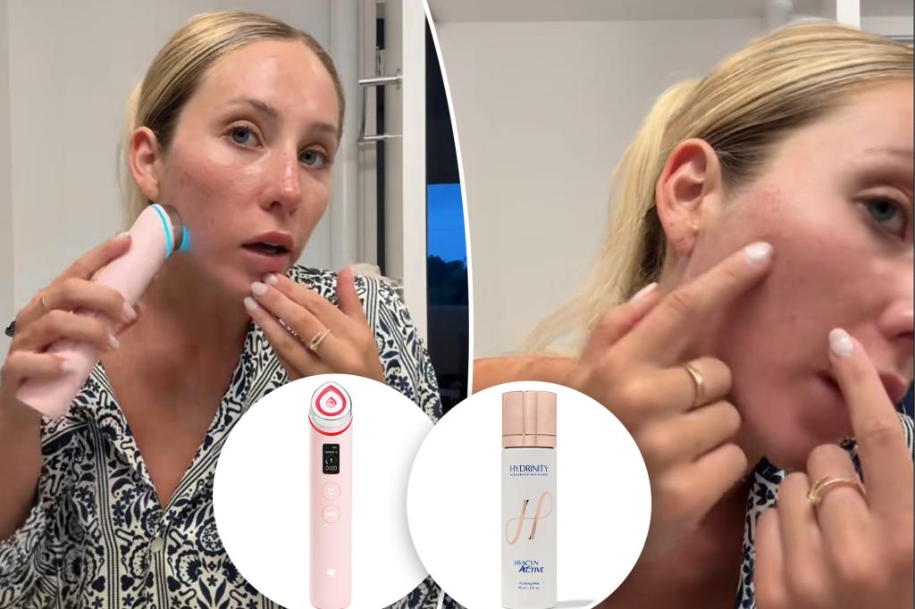 Alix Earle discusses her journey with acne and her current skincare regimen.