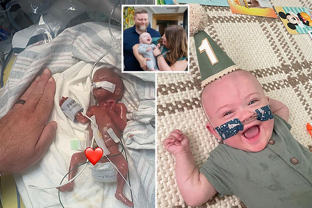 Baby born extremely early beats the odds to celebrate first birthday