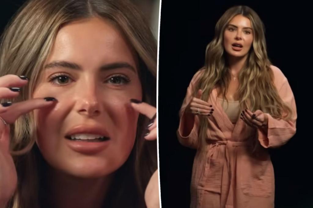 Brielle Biermann expresses remorse about receiving fillers when she was young