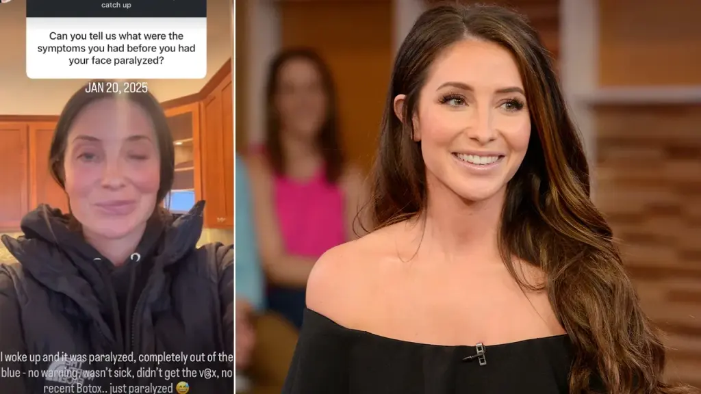 Bristol Palin reports that her facial paralysis has improved to 70% recovery after being diagnosed.