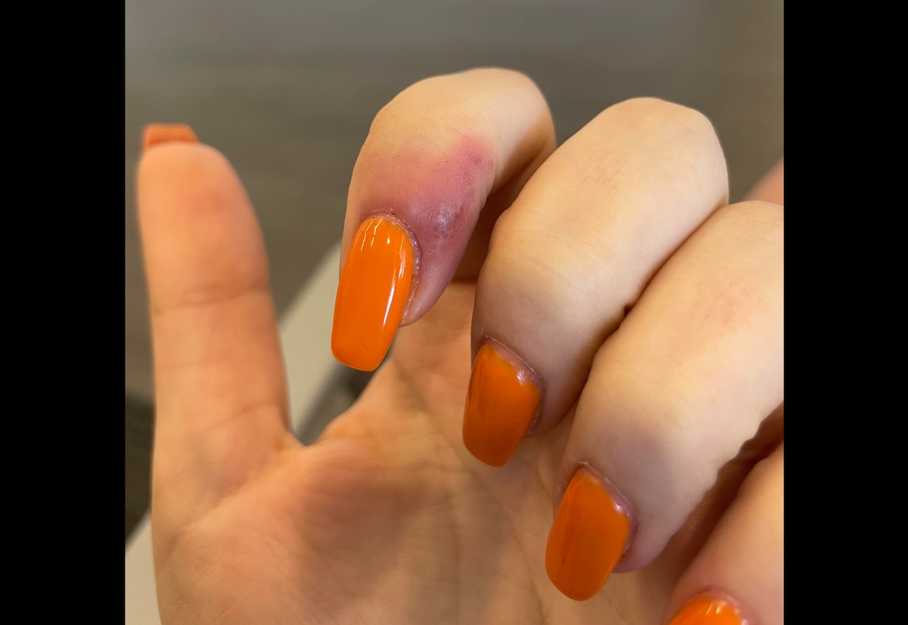 Customer in Portland who said she contracted genital herpes at a nail salon reaches lawsuit settlement