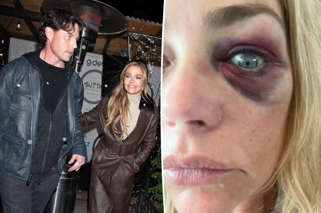 Denise Richards' separated husband Aaron Phypers rejects claims of abuse