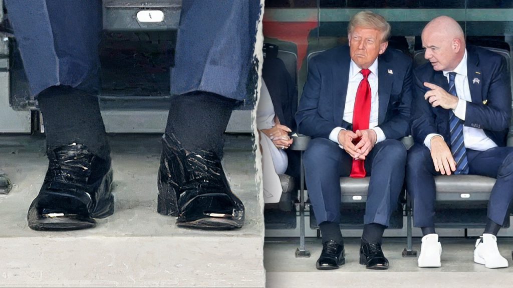 Doctors talk about Trump's puffy legs and bruised hand after pictures emerge.