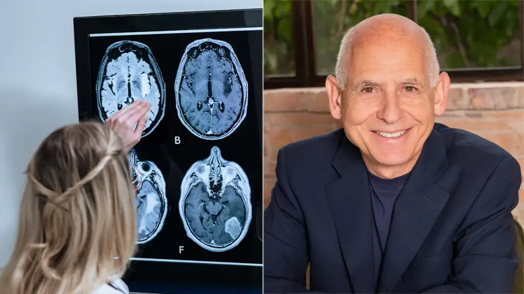 Dr. Amen shares 11 strategies to prevent Alzheimer's disease before symptoms develop.