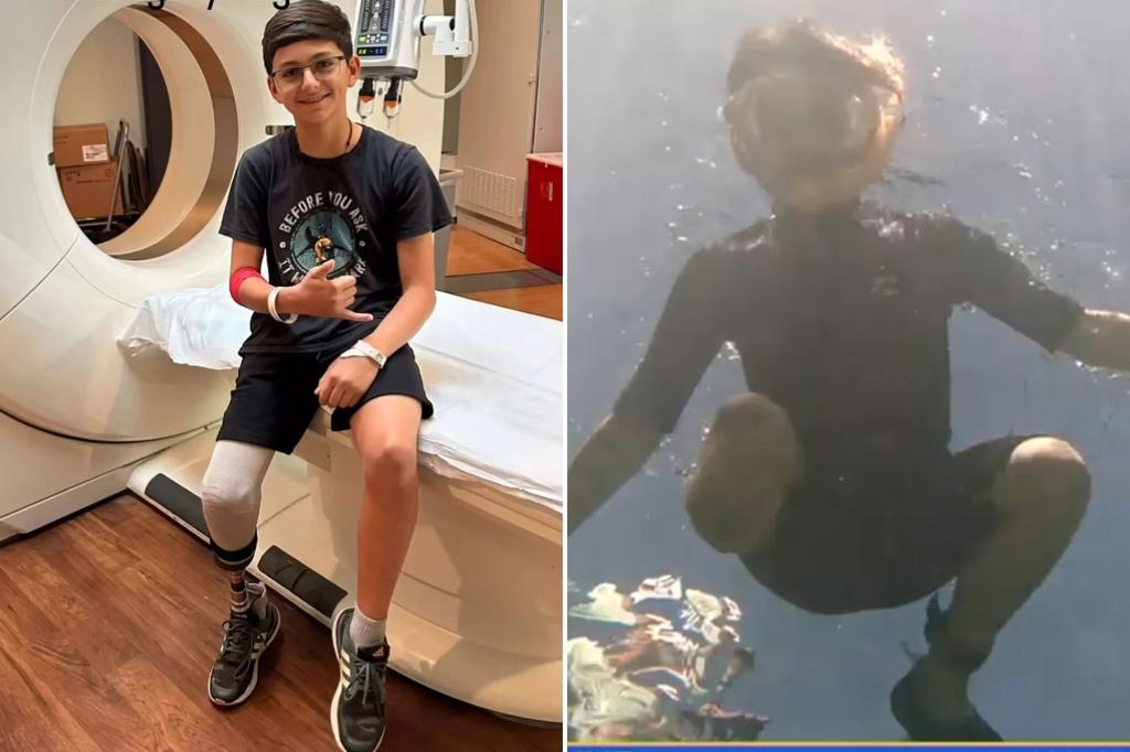 Father remembers the terrifying incident when his 10-year-old son was bitten by a shark in Florida.