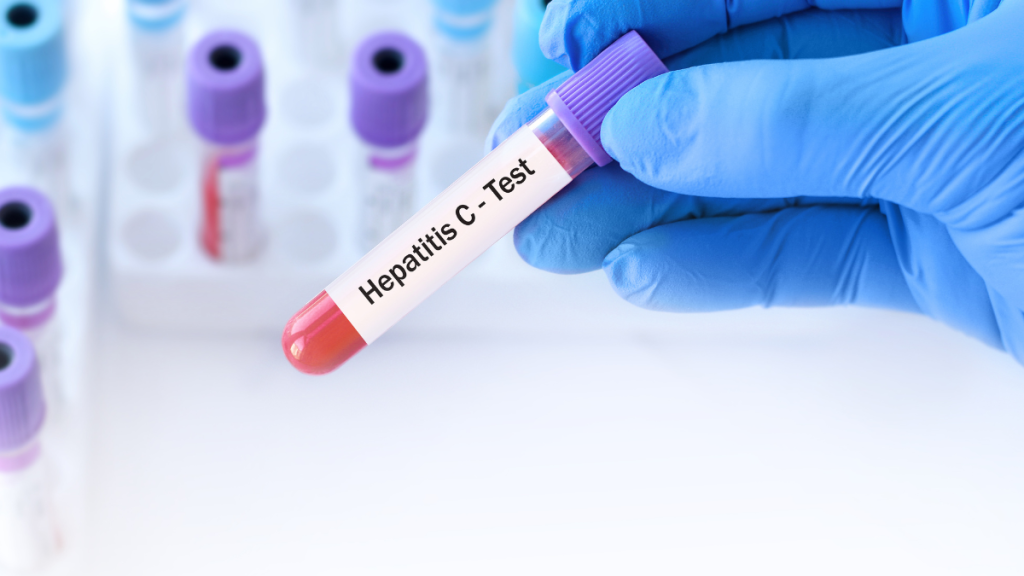 Funding Opportunity of $100 Million Launched to Eradicate Hepatitis C