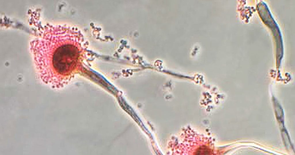 Fungal infections are becoming more difficult to manage.