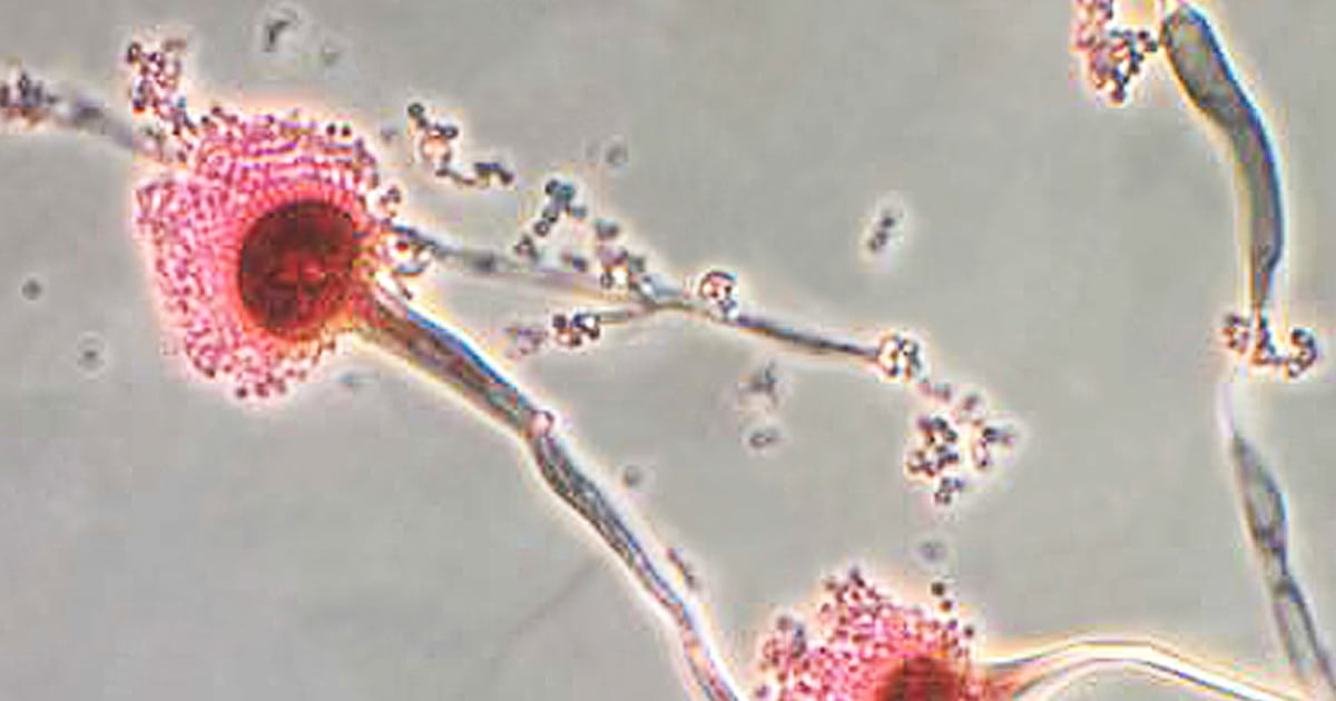 Fungal infections are becoming more difficult to manage.