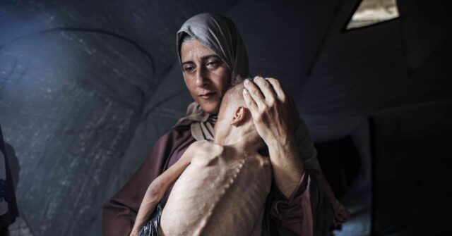 Gaza Child Featured in Popular 'Starvation' Image Has Muscular Condition