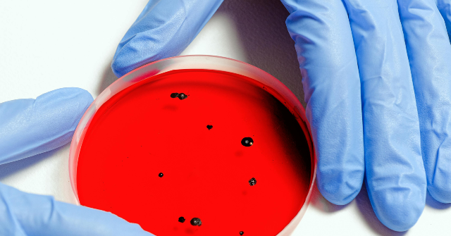 Health Officials in NYC Caution About Legionnaire's Disease Outbreak